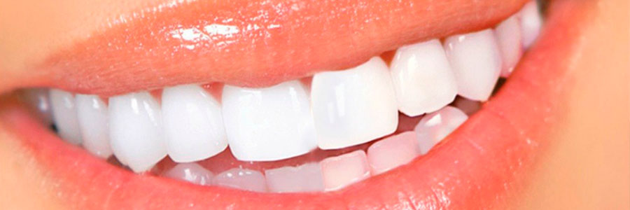 Отбеливание зубов домашними средствами